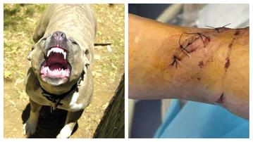 A sinistra un esemplare di pitbull e a destra le ferite riportate dalla donna aggredita