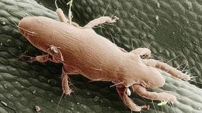 Gli effetti della dermatite L’acaro dei tarli del legno in un’immagine ingrandita al  microscopio